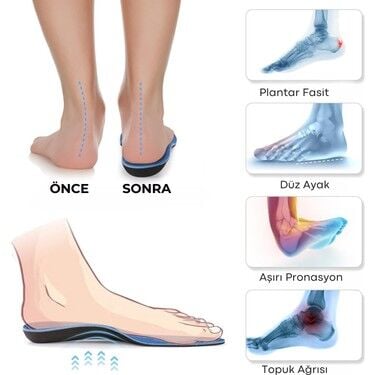 Topuk Dikeni Kişiye Özel Tabanlık (Özel Cihaz ile Analiz Yapılarak Hazırlanmaktadır)