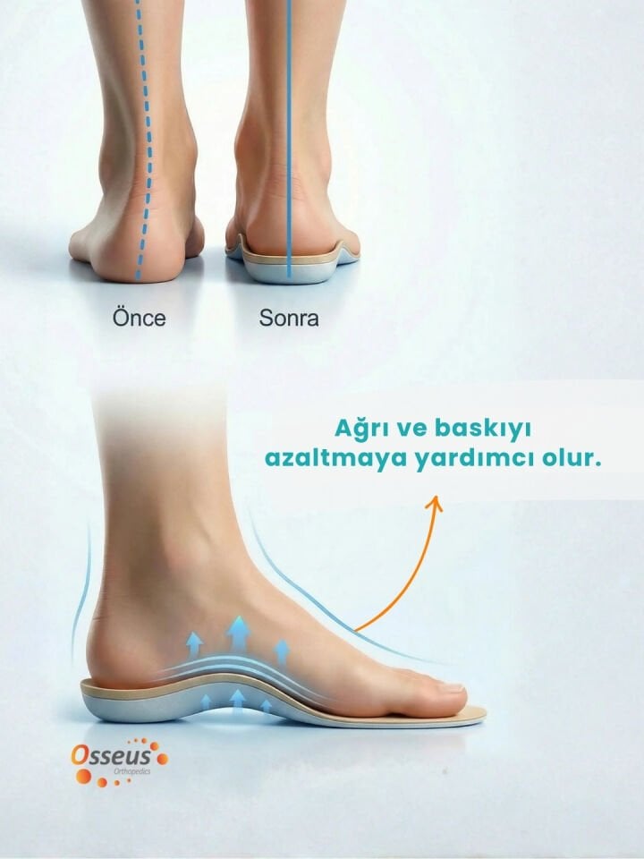 FixFlex Topuk Dikeni Kişiye Özel Tabanlık (Özel Cihaz İle Analiz Yapılarak Hazırlanmaktadır)