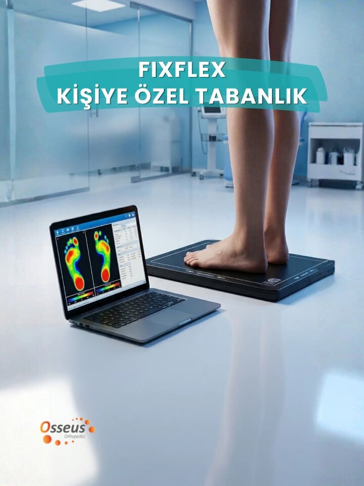 FixFlex Yüksek Kavisli Kişiye Özel Tabanlık (Özel Cihaz İle Analiz Yapılarak Hazırlanmaktadır)
