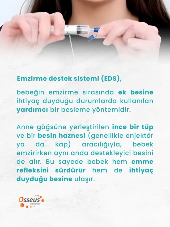 FIXFLEX EMZIRME DESTEK SISTEMI (EDS) SETI 0-1 AYLIK NO:04 KIRMIZI