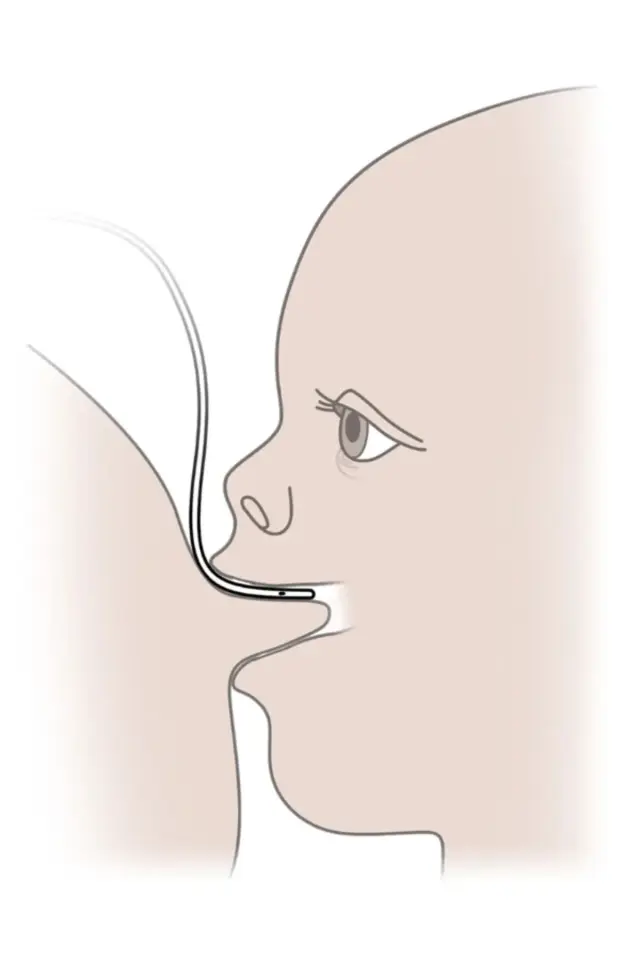 FixFlex Emzirme Destek Sistemi (EDS) Seti 2-3 Aylık No:06 Yeşil