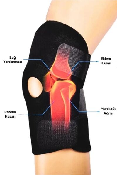FixFlex Kısa Patella Destekli Dizlik (Standart)