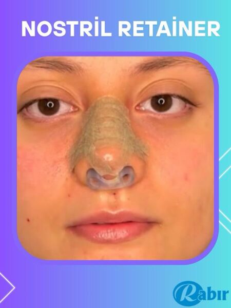Rabır Nostril Retainer (Burun Deliği Şekillendirici)