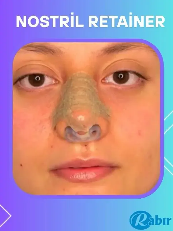 Rabır Nostril Retainer (Burun Deliği Şekillendirici) 9